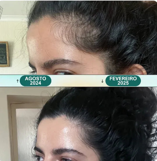 Massageador Elétrico para Couro Cabeludo